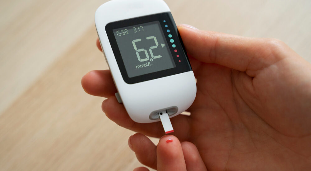 Outsource DME Billing